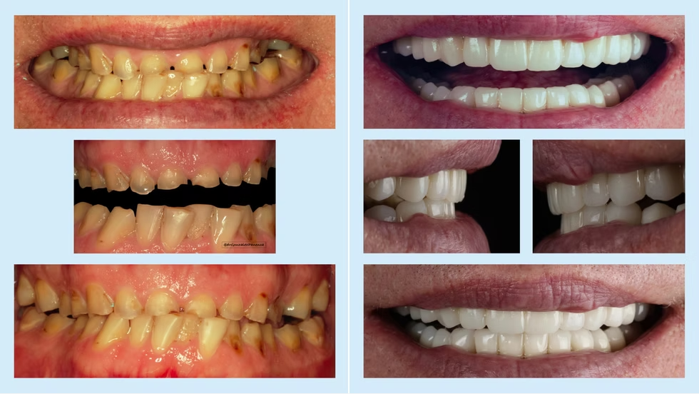 Before and after 7