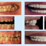 Before and after 7