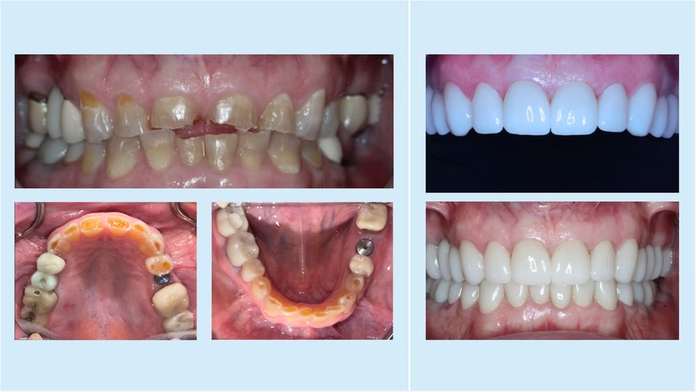 Before and after 6