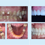 Before and after 6