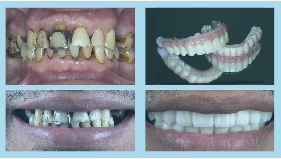 Before and after 5