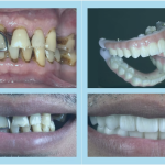 Before and after 5