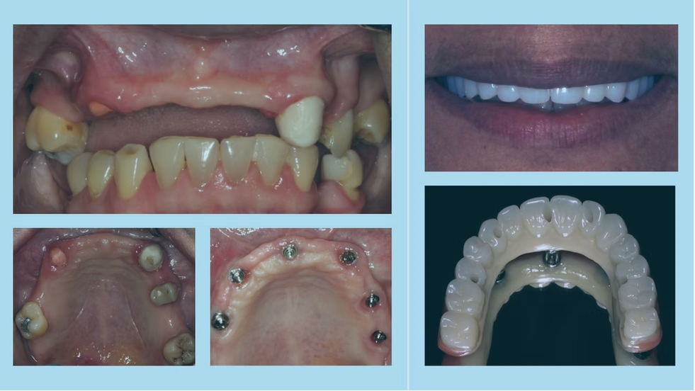 Before and after 4