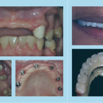 Before and after 4