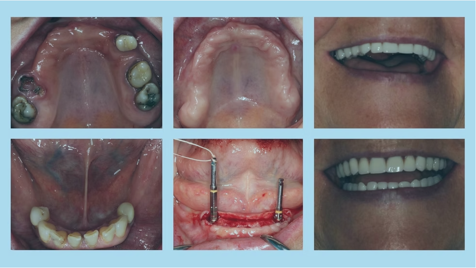 Before and after 2