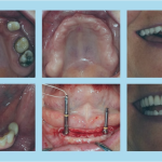 Before and after 2