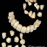 Dental crowns for different types of teeth
