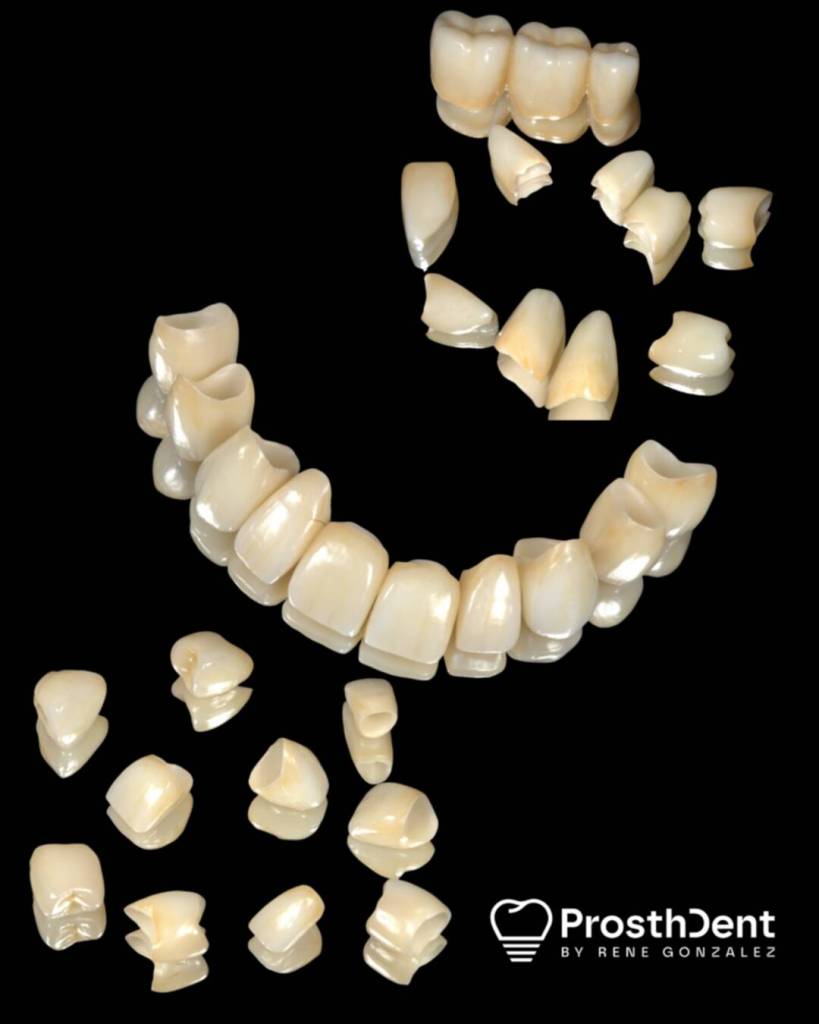 Dental crowns for different types of teeth